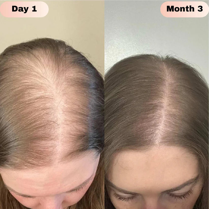 Nodiinfuse® Hair Growth Roll-On Serum – NODI RACK